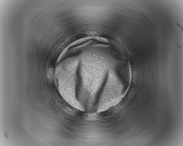 X0000099500093200806051133