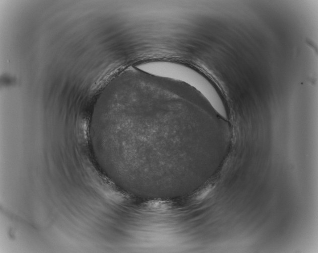 X0000099500117200806051132