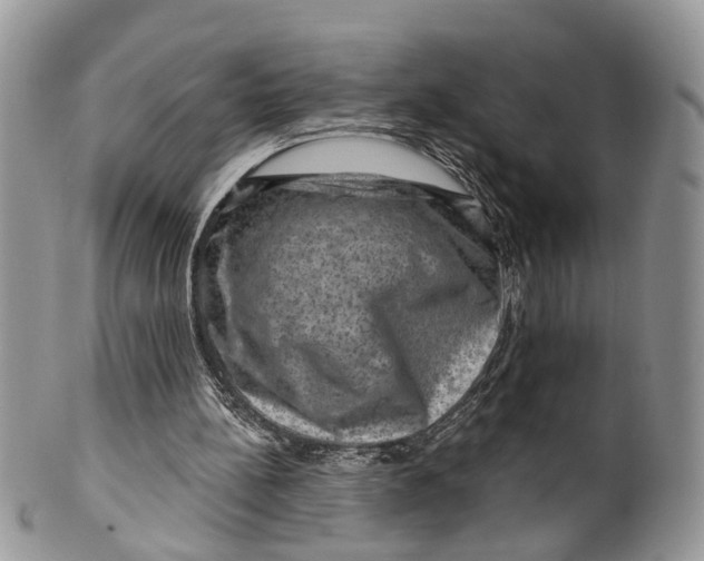 X0000099500148200806051131