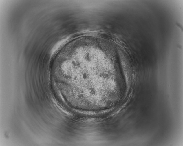 X0000099500149200806051131