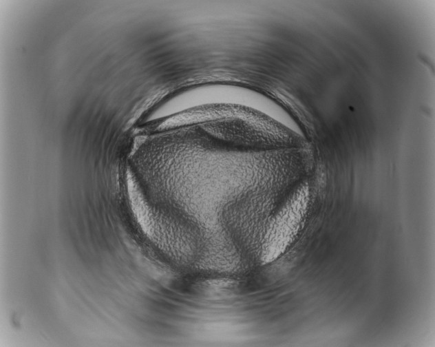 X0000099500158200806051131