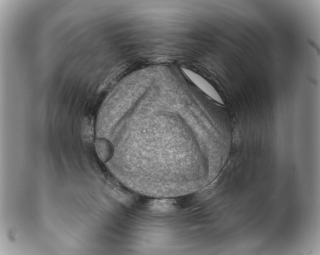 X0000099500179200806051132