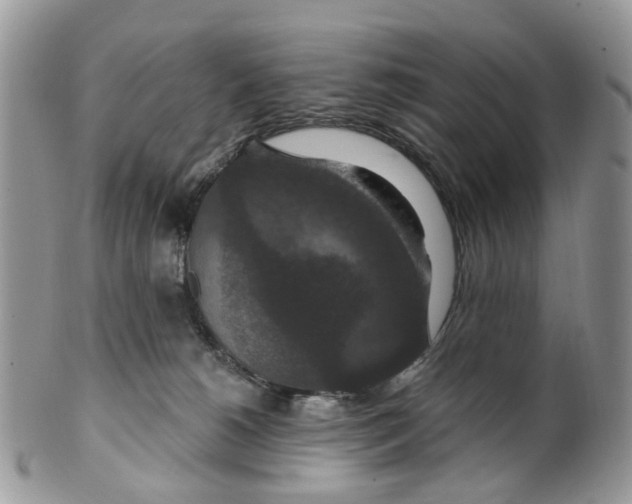 X0000099500180200806051132