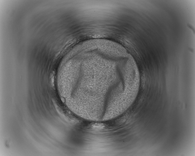 X0000099500214200806051131