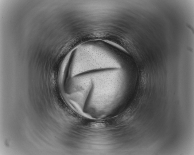 X0000099500220200806051131