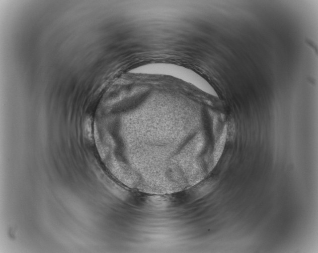 X0000099500238200806051130