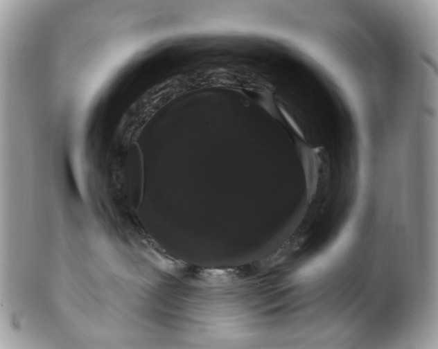 X0000099500239200806051130