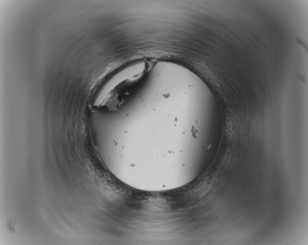 X0000099500256200806051130