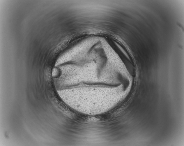 X0000099500257200806051130