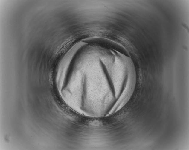 X0000099500258200806051130