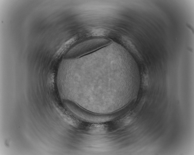 X0000099500260200806051130