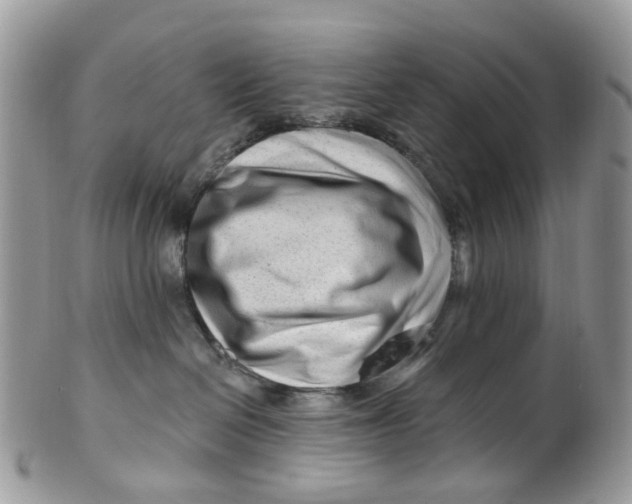 X0000099500286200806051130