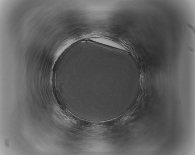 X0000099500292200806051129