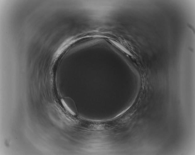 X0000099500295200806051129