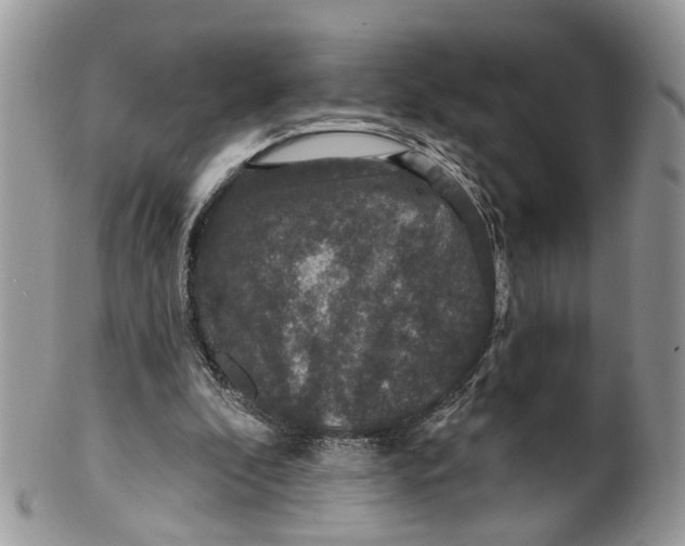 X0000099500296200806051129