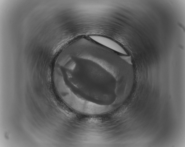 X0000099500303200806051129