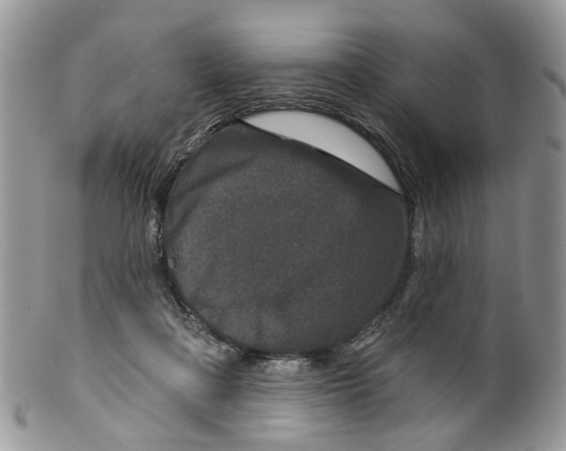 X0000099500314200806051129