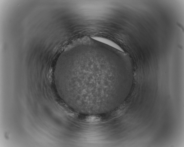 X0000099500319200806051129