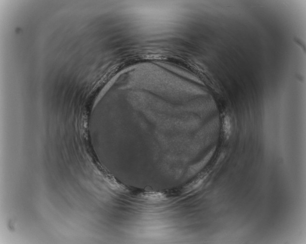 X0000099500322200806051129