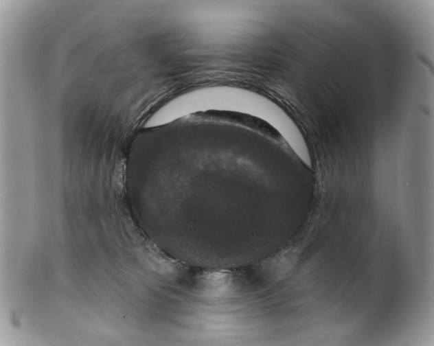 X0000099500325200806051129