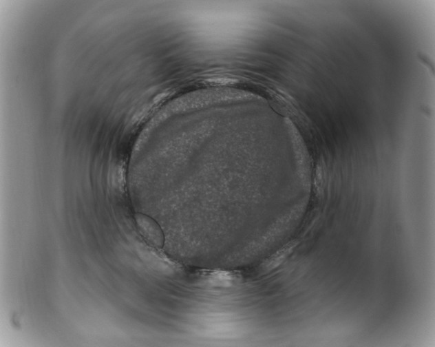 X0000099500330200806051129