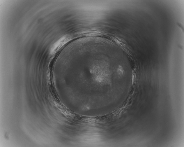 X0000099500339200806051128