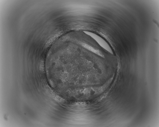 X0000099500353200806051128