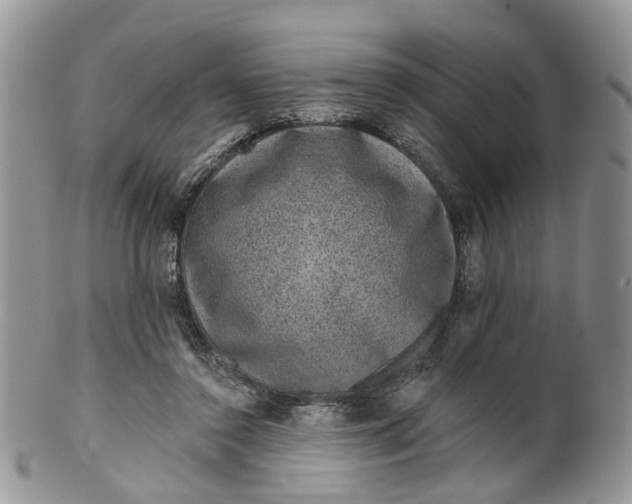 X0000099500356200806051128