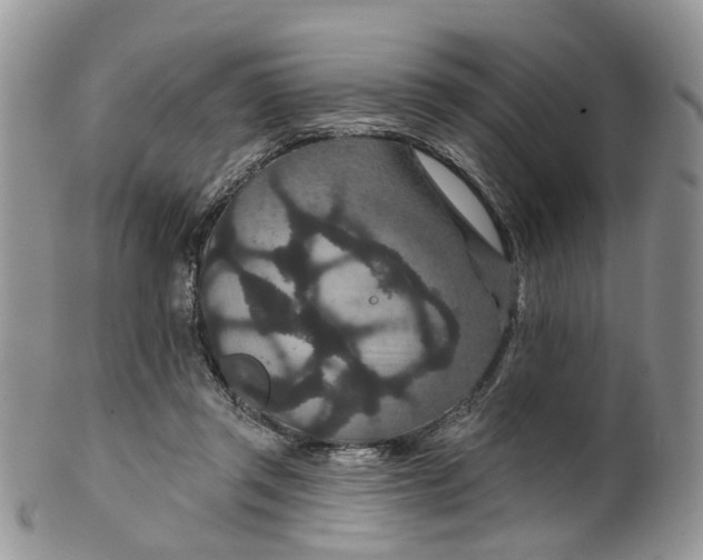 X0000099500357200806051128