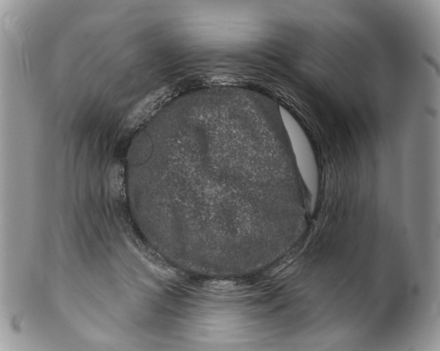 X0000099500361200806051128