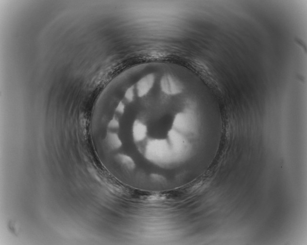 X0000099500366200806051128