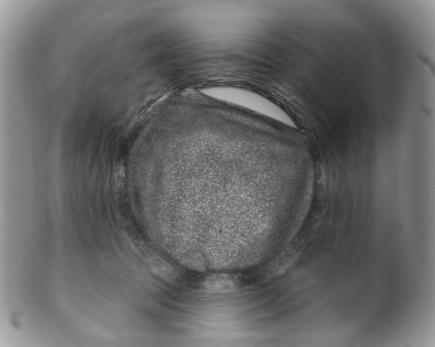 X0000099500369200806051128