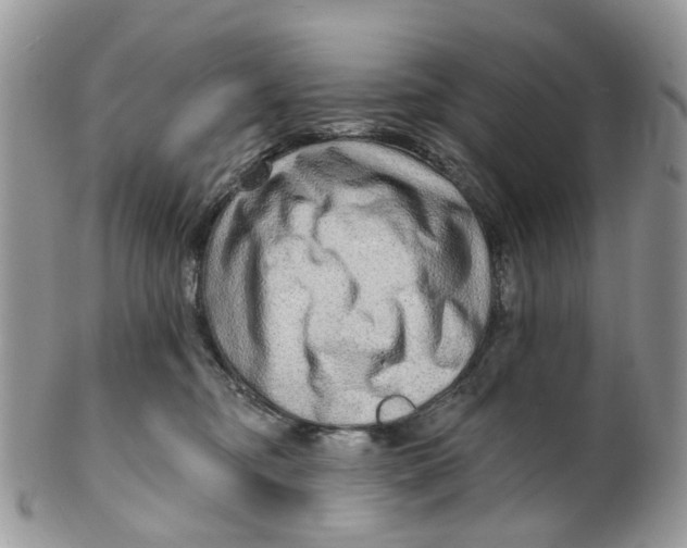 X0000099500374200806051129