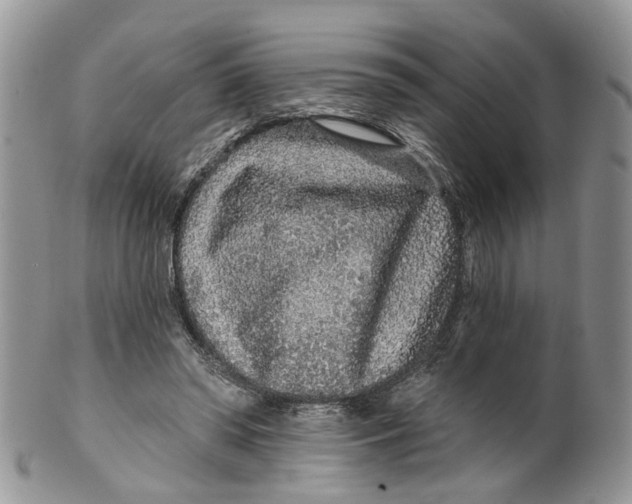 X0000099500398200806051128