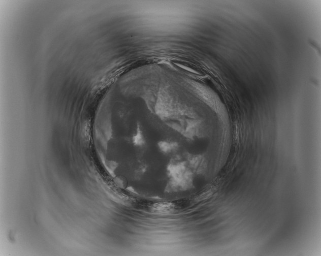 X0000099500410200806051128