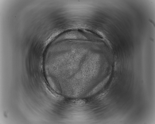 X0000099500443200806051127