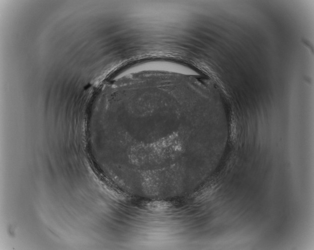 X0000099500444200806051127