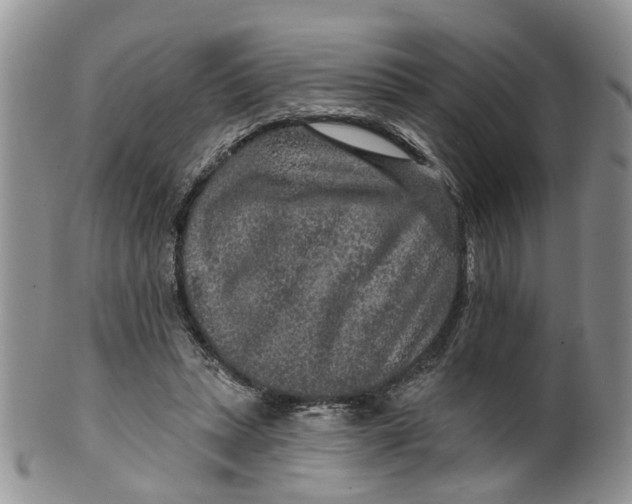 X0000099500447200806051127