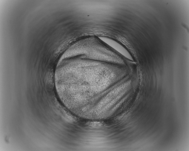 X0000099500449200806051127