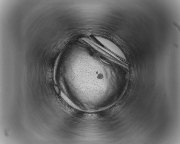 X0000099500469200806051127