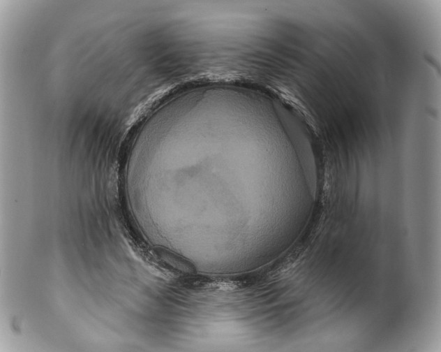 X0000099500492200806051126