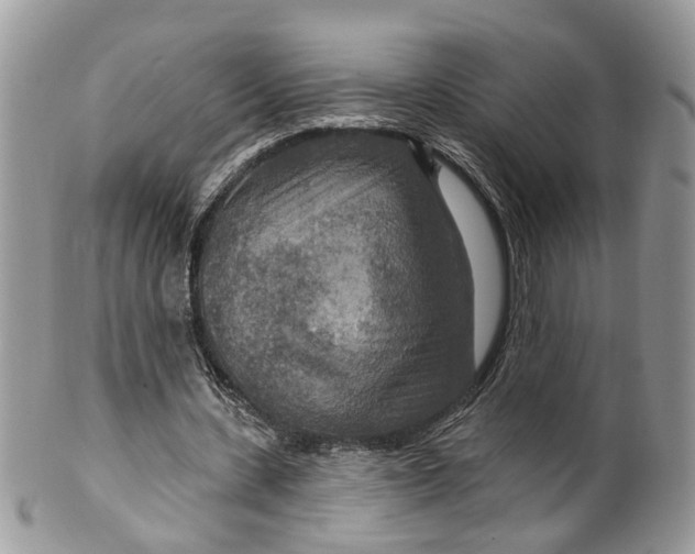 X0000099500531200806051125