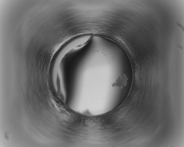 X0000099500532200806051125