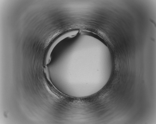 X0000099500538200806051125