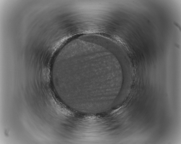 X0000099500540200806051125