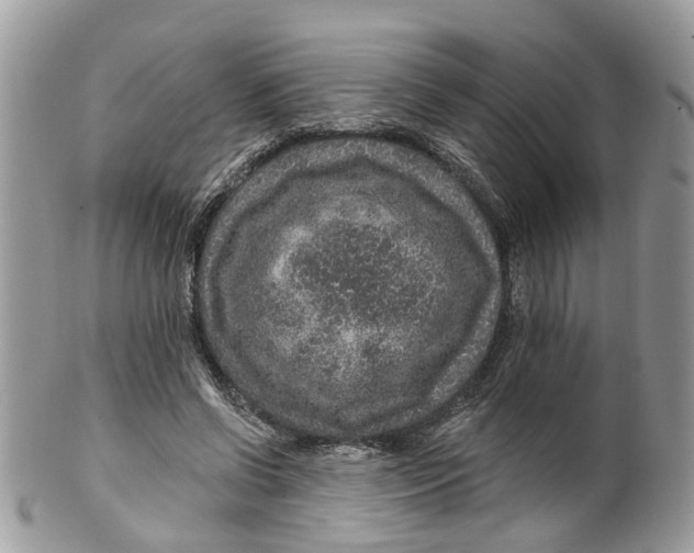 X0000099500542200806051125