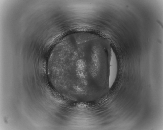 X0000099500547200806051126