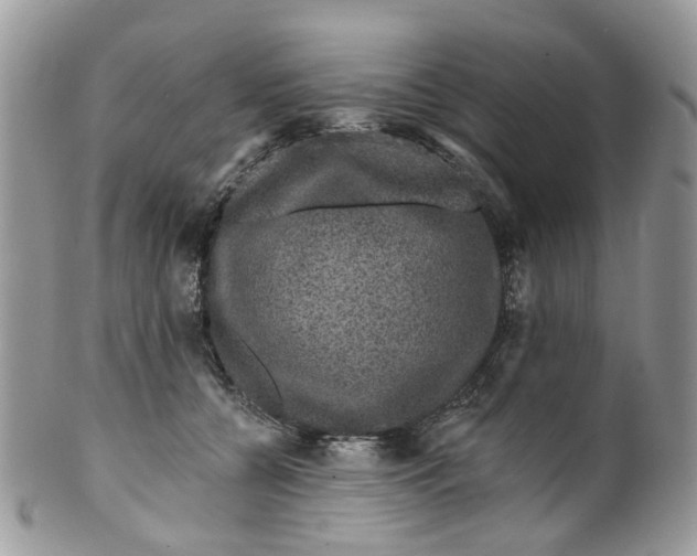 X0000099500560200806051126