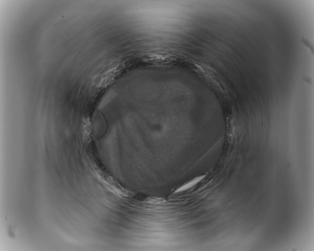 X0000099500563200806051126