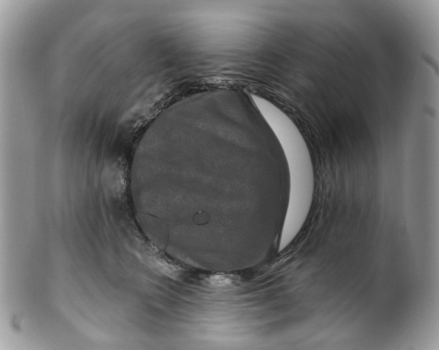 X0000099500566200806051126